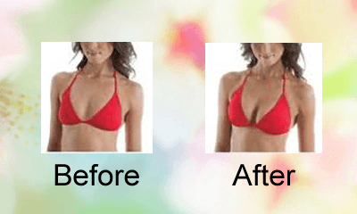 before after